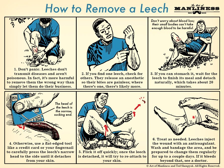 leeches for blood removal