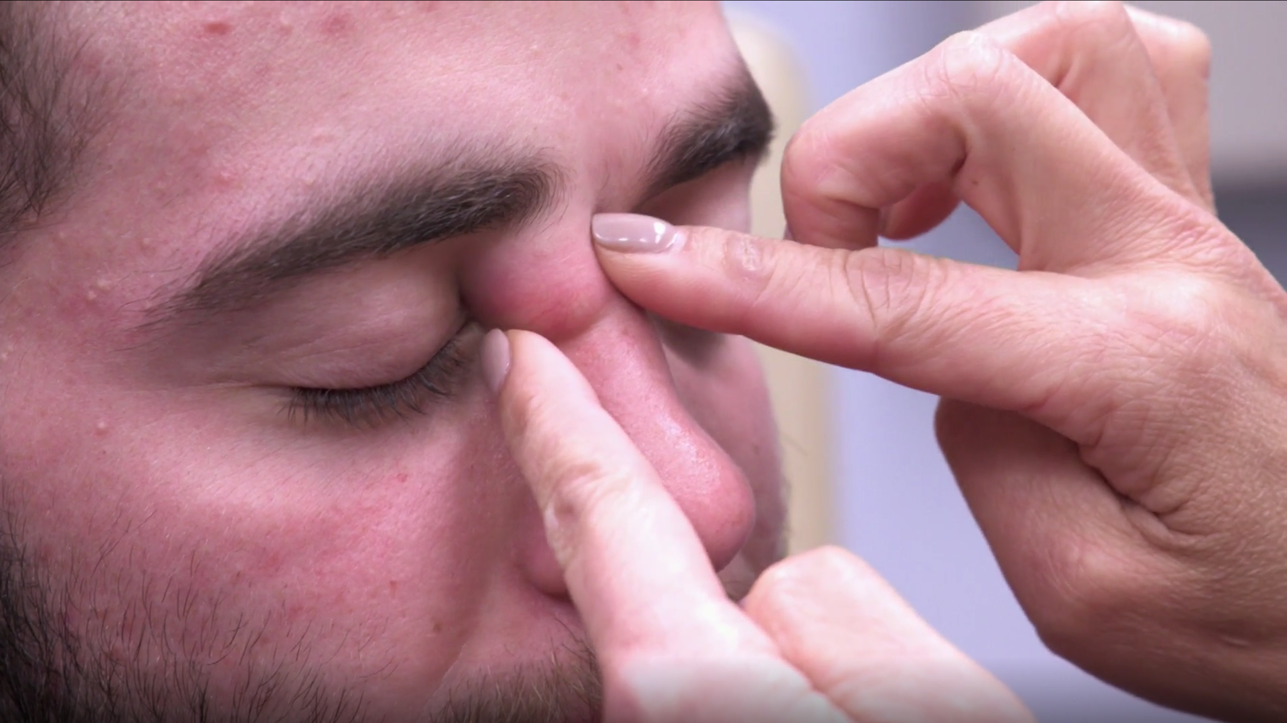 The Way To Pop Pimple